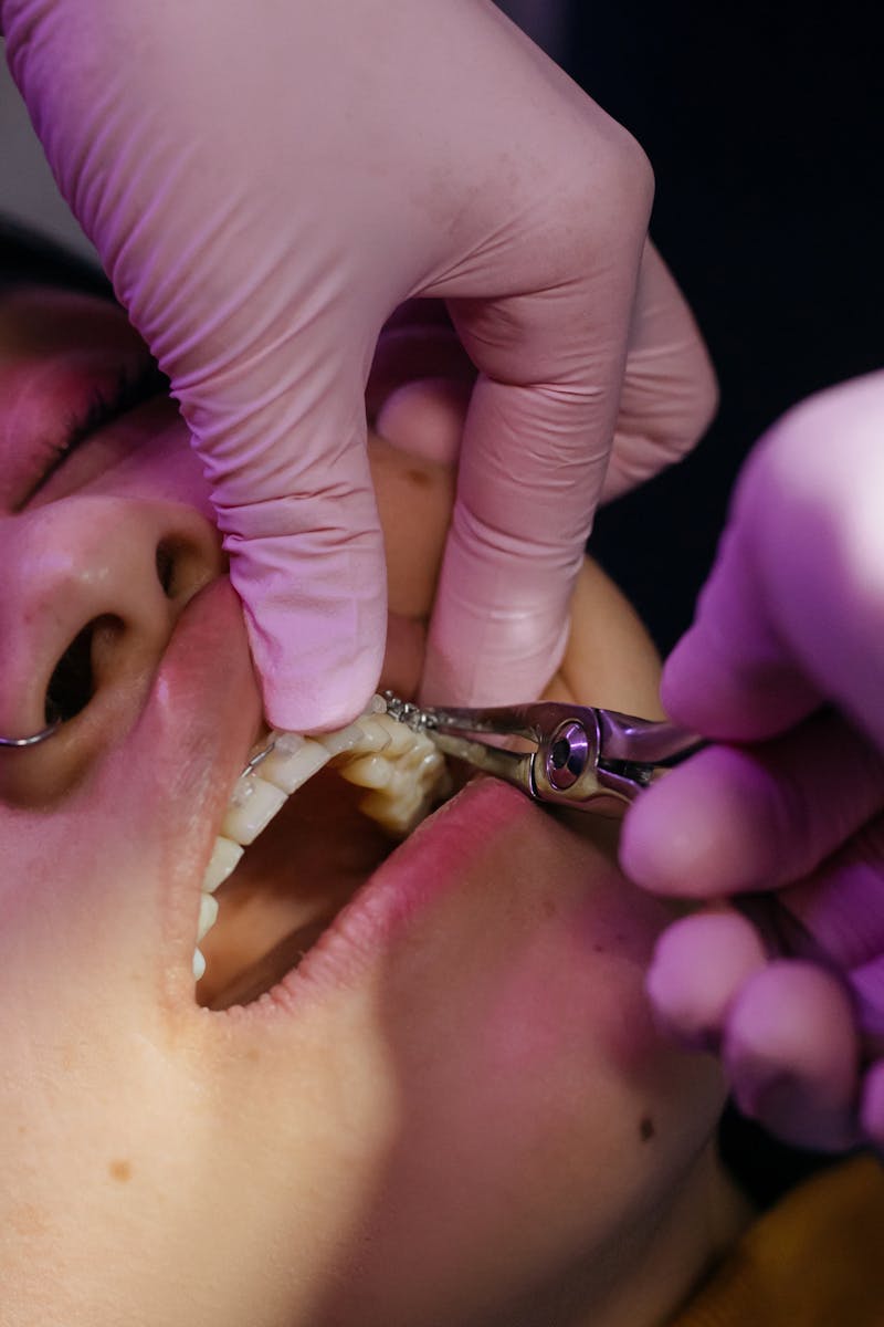 Dental consultation